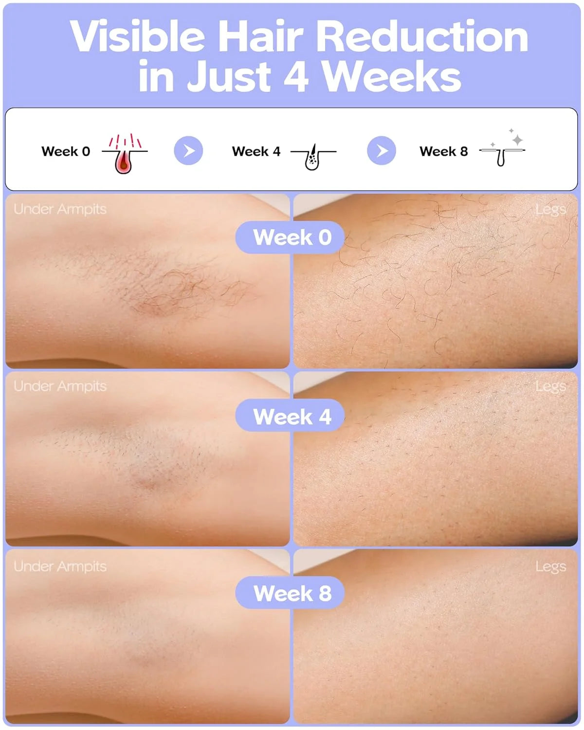 Fashiquee IPL Laser Hair Removal Device
