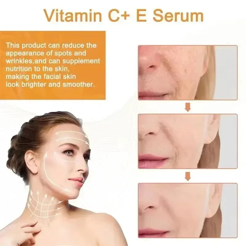Vitamin C Whitening Freckles Facial Serum