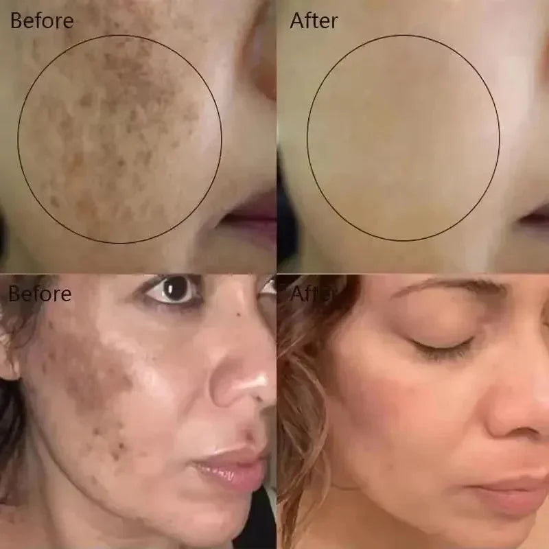 Vitamin C Whitening Freckles Facial Serum