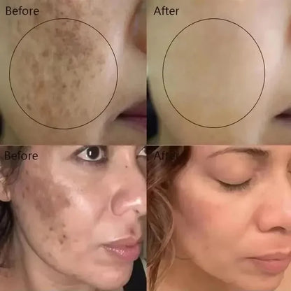 Vitamin C Whitening Freckles Facial Serum