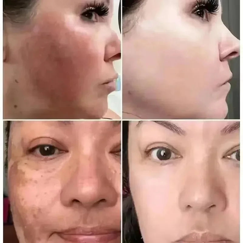 Vitamin C Whitening Freckles Facial Serum