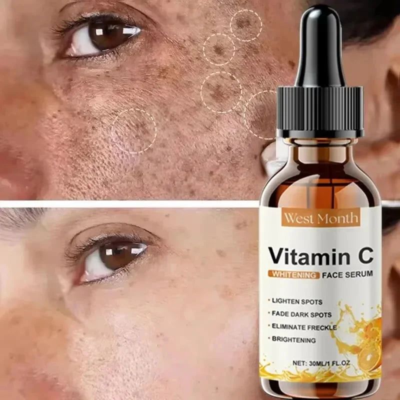 Vitamin C Whitening Freckles Facial Serum