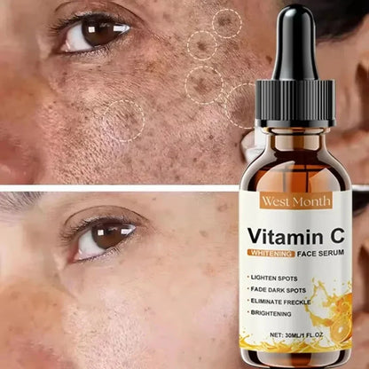 Vitamin C Whitening Freckles Facial Serum