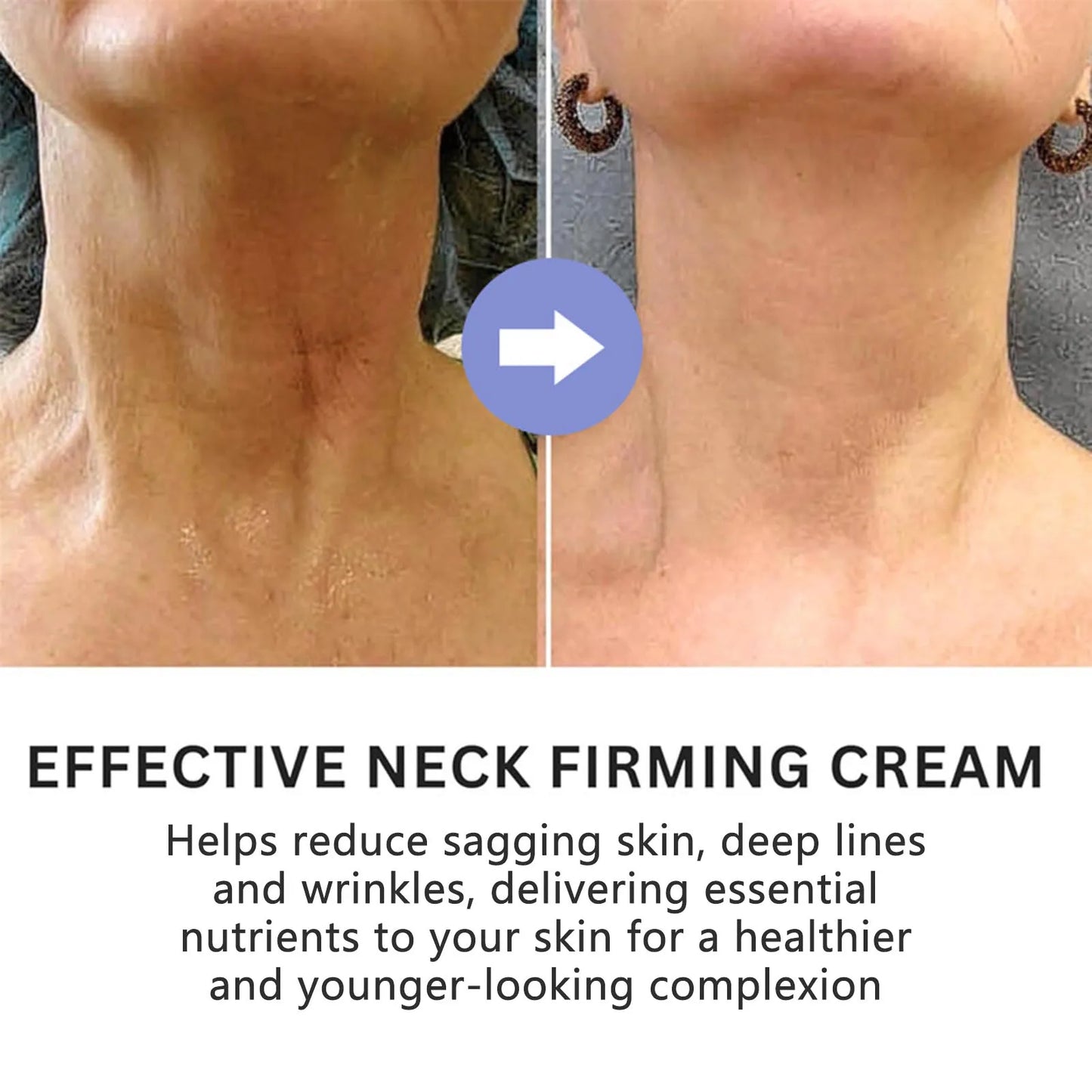 Fade Neck Lines Massage Cream